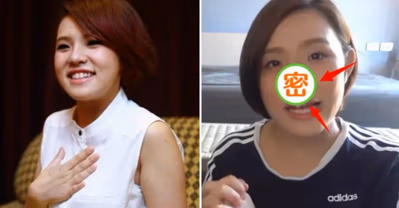 32歲女星「謝依霖承認整 容」！鼻子變歪一推就動需手術修復，曾經還全身抽脂：別被「自然就是美」給綁架
