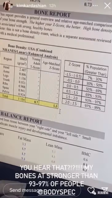 卡戴珊曬體檢報告大翻車 網:隆胸假體都暴露啦