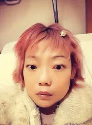 瘦到只有22公斤!她嫁入豪門8年「因患罕見疾病」被掃地出門 前夫拖欠贍養費「靠頑強求生欲」和病魔做鬥爭