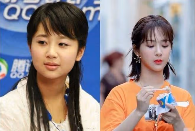 閆妮新劇臉僵如石？看看這7位美女明星，都走上了整容的不歸路