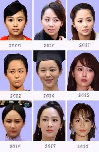 閆妮新劇臉僵如石？看看這7位美女明星，都走上了整容的不歸路