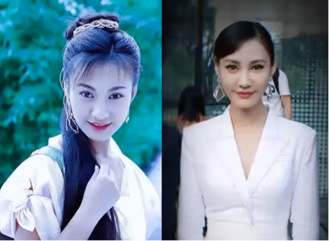 閆妮新劇臉僵如石?看看這7位美女明星,都走上了整容的不歸路