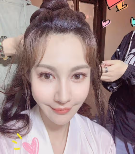 閆妮新劇臉僵如石?看看這7位美女明星,都走上了整容的不歸路