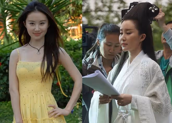 閆妮新劇臉僵如石?看看這7位美女明星,都走上了整容的不歸路