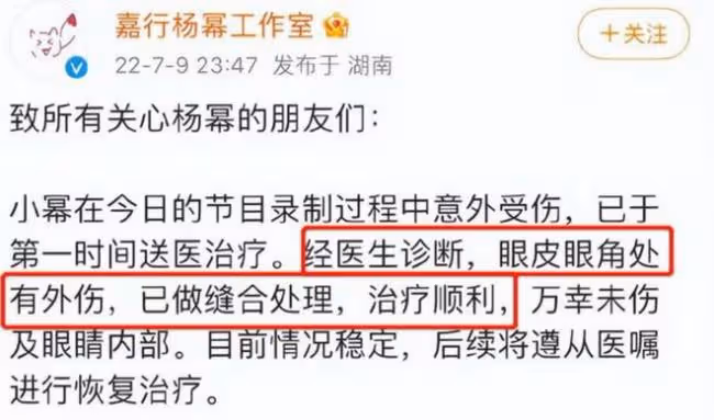 楊冪維密造型好性感:穿弔帶睡衣 大秀事業線