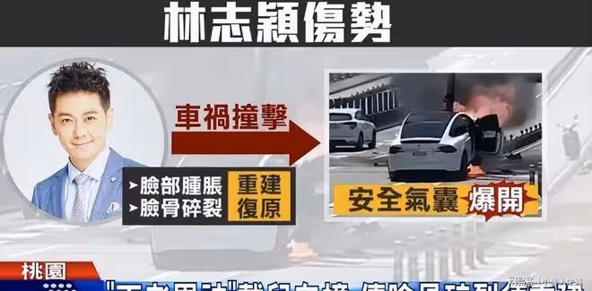 林志穎傷勢好轉可使用社交軟體，面部重建手術恐無法還原本來面貌