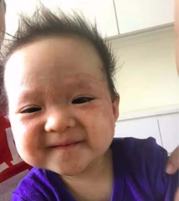 血淚史!TVB名主持曝兒子曾患嚴重濕疹,遍布全身更被誤認是虐兒