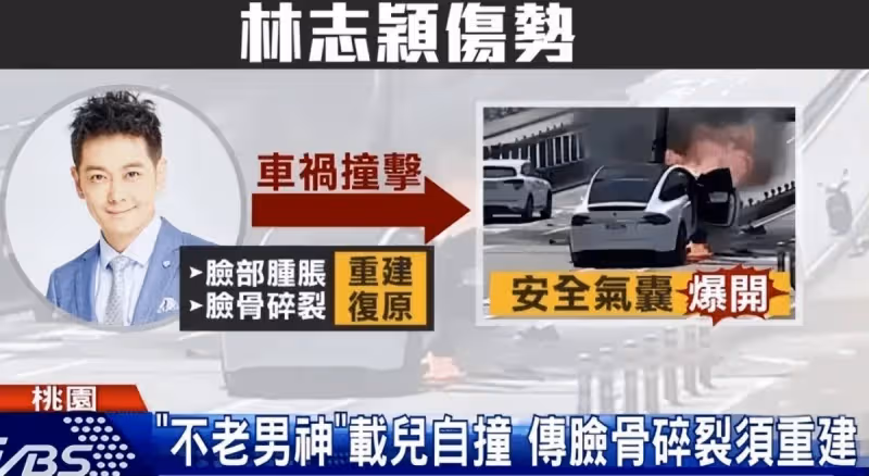 車友曝林志穎近況，醫生透露其骨頭復位得「蠻漂亮」