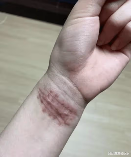 崔雪莉又一閨蜜試圖自殺!曬割腕照稱被霸凌10年,連父親葬禮都不放過