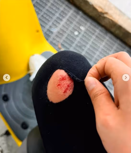 27歲美女主持發生車禍!低頭看導航撞上貨車,多處受傷滲血險毀容