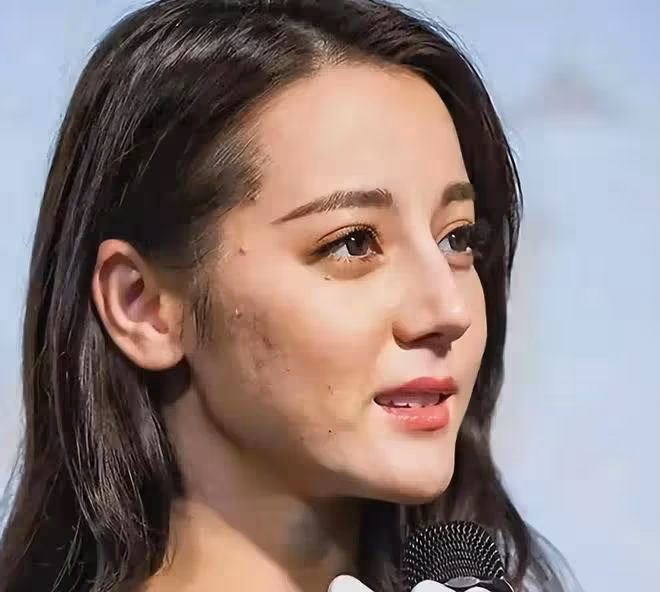 滿臉痘、肚子大、皮膚黑!生圖裡的明星,讓我看見了人間真實