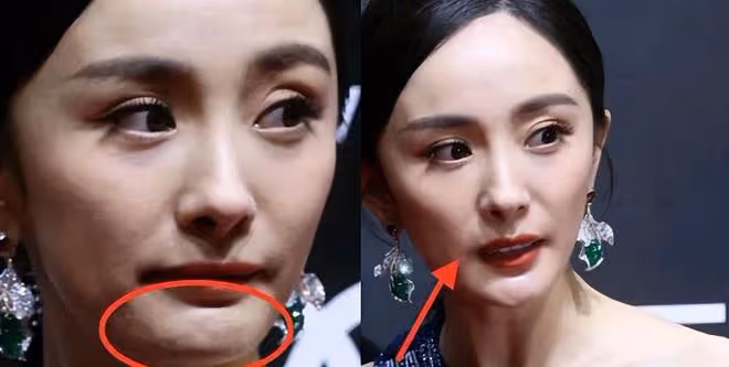滿臉痘、肚子大、皮膚黑!生圖裡的明星,讓我看見了人間真實