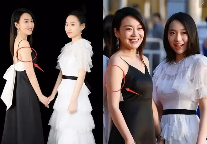 滿臉痘、肚子大、皮膚黑!生圖裡的明星,讓我看見了人間真實