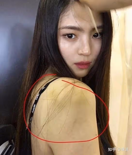 全身淤青的韓國女星,詭異紅色畫風暗示「SOS」,囚禁?虐待?