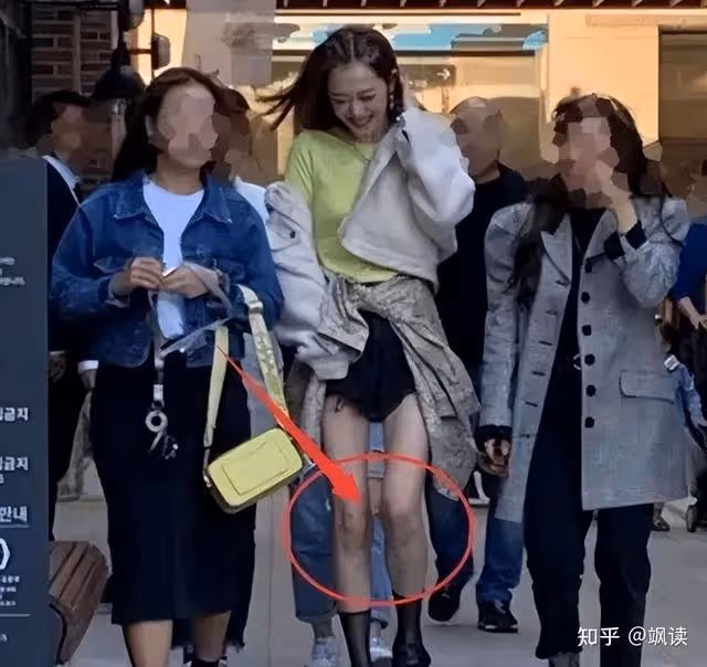 全身淤青的韓國女星,詭異紅色畫風暗示「SOS」,囚禁?虐待?