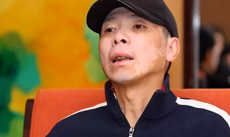 被病魔折磨的六位明星，身家過億，再多的錢也買不到好身材