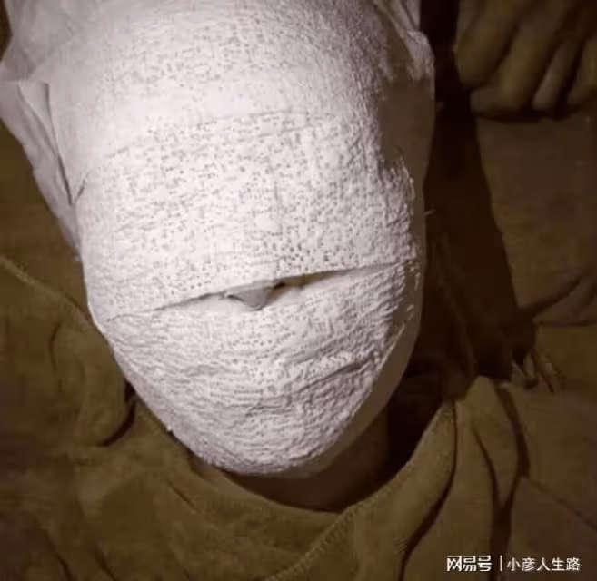 林志穎車禍後首曝近照，和妻子握手度過難關，顏值恐難恢復原貌