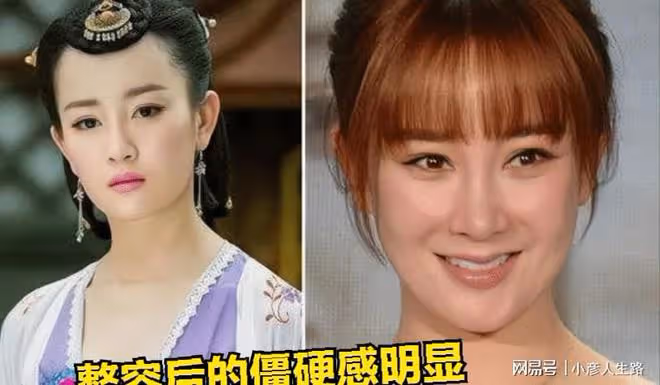 林志穎車禍後首曝近照,和妻子握手度過難關,顏值恐難恢復原貌