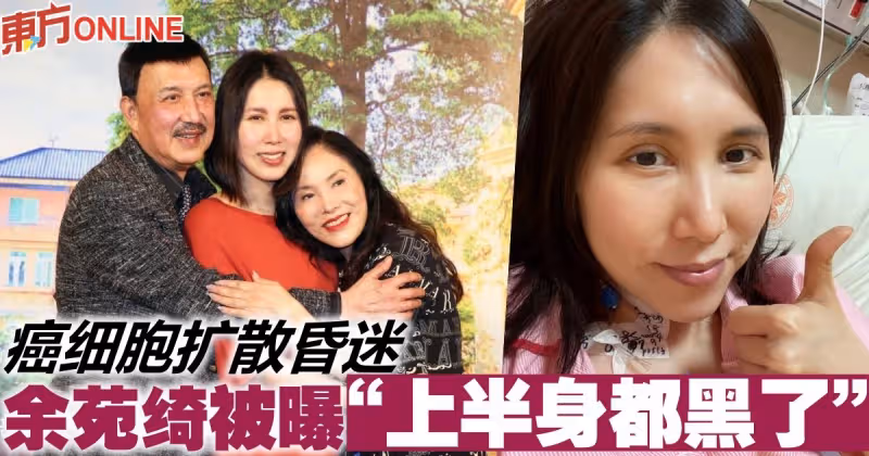 癌細胞擴散昏迷　余苑綺被曝「上半身都黑了」