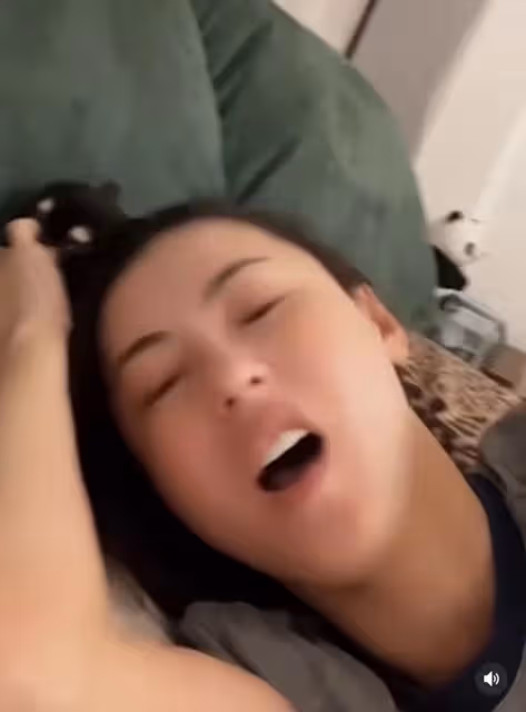 42歲張柏芝曬近況,與狗同眠意外被咬傷痛苦尖叫,曬傷勢滿手咬痕