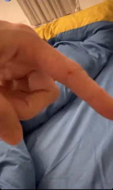 42歲張柏芝曬近況,與狗同眠意外被咬傷痛苦尖叫,曬傷勢滿手咬痕