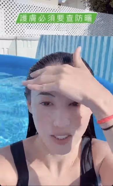 42歲張柏芝曬近況,與狗同眠意外被咬傷痛苦尖叫,曬傷勢滿手咬痕