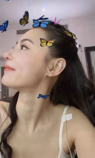 42歲張柏芝曬近況,與狗同眠意外被咬傷痛苦尖叫,曬傷勢滿手咬痕
