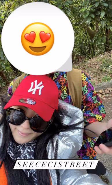 42歲張柏芝曬近況,與狗同眠意外被咬傷痛苦尖叫,曬傷勢滿手咬痕
