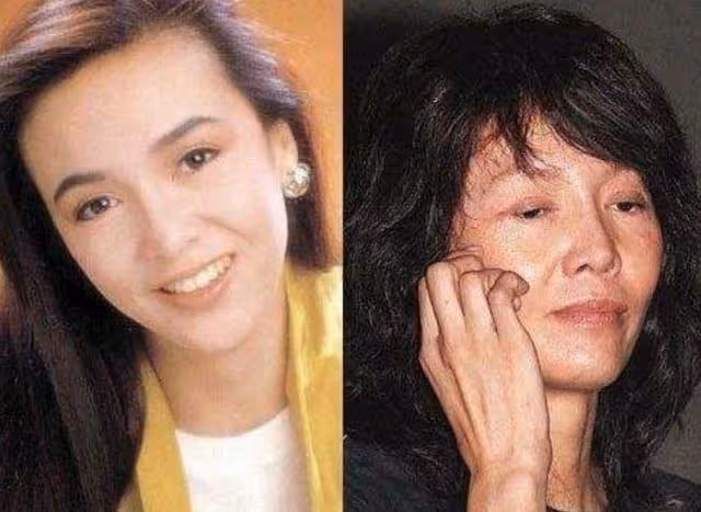 表面「美若天仙」,其實歪瓜裂棗的6位女星,個個整的「驚艷」