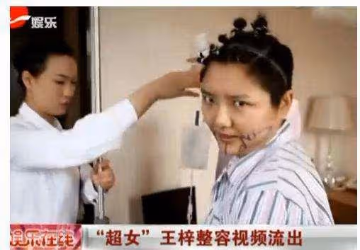 表面「美若天仙」,其實歪瓜裂棗的6位女星,個個整的「驚艷」