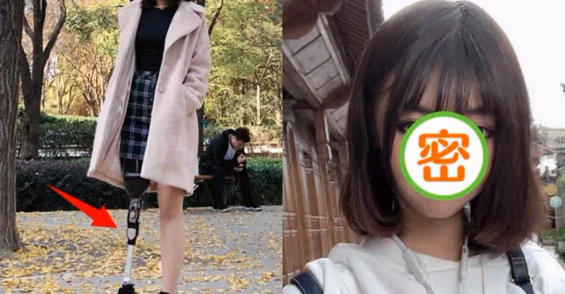 單腿女孩戴著「金屬假肢」跳舞，卻因「長太美」被上百位男生追著告白，網友：這長相太吃香