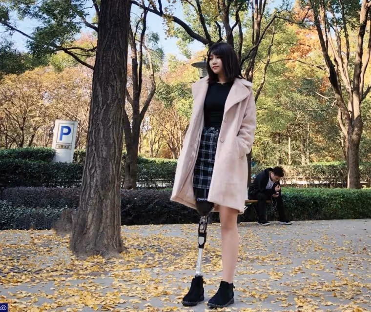 單腿女孩戴著「金屬假肢」跳舞,卻因「長太美」被上百位男生追著告白,網友:這長相太吃香