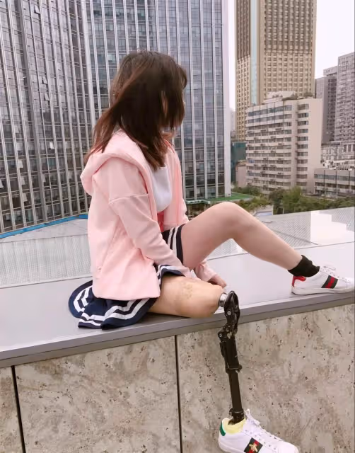 單腿女孩戴著「金屬假肢」跳舞,卻因「長太美」被上百位男生追著告白,網友:這長相太吃香