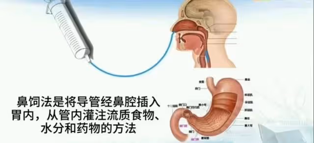 林志穎被曝面部纏滿紗布,術後會留下永久疤痕,目前進食靠鼻飼