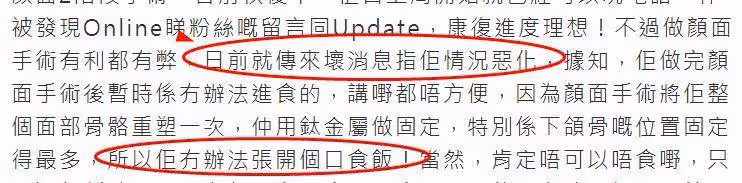林志穎恢復現狀不理想,需插鼻胃管進食,面部神經元修復是關鍵