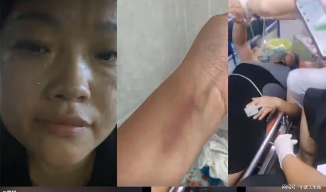 網紅星姐被親媽搜身喝百草枯,朋友墊付4000元醫藥費,兒子才6歲