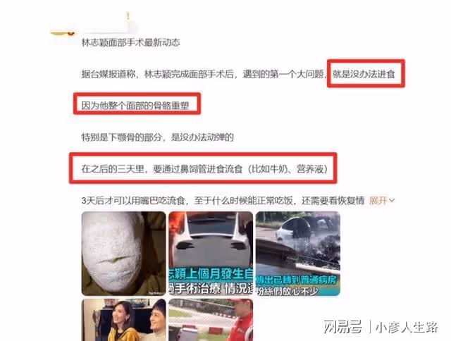 曝林志穎手術惡化,只能靠鼻胃管進食,經紀公司回應令人擔憂!