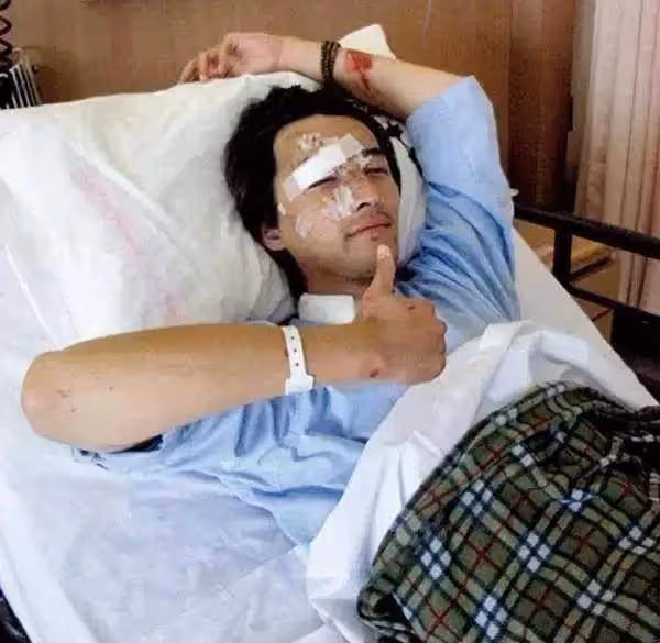 林志穎整容後狀態不佳，很難恢復以前的容貌，讓人想起胡歌的車禍