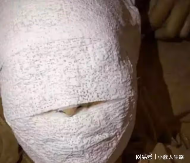 林志穎被曝進食困難,需要採用鼻飼輔助,可能會留下永久性疤痕