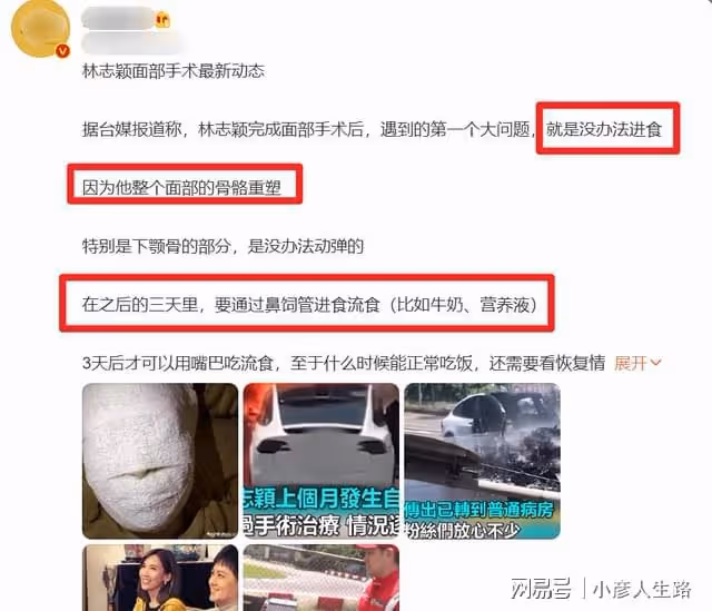 林志穎被曝進食困難,需要採用鼻飼輔助,可能會留下永久性疤痕