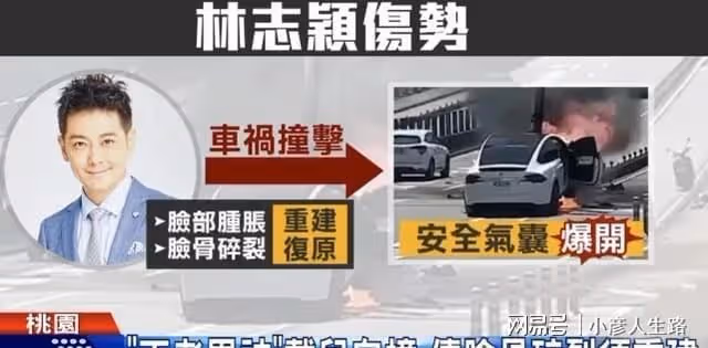 曝林志穎手術細節,無法張口說話也有問題,如恢復錯位或重新整形