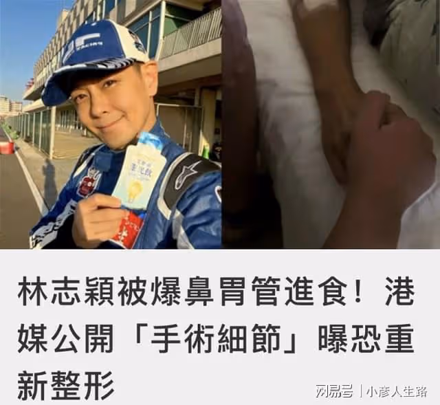 曝林志穎手術細節,無法張口說話也有問題,如恢復錯位或重新整形