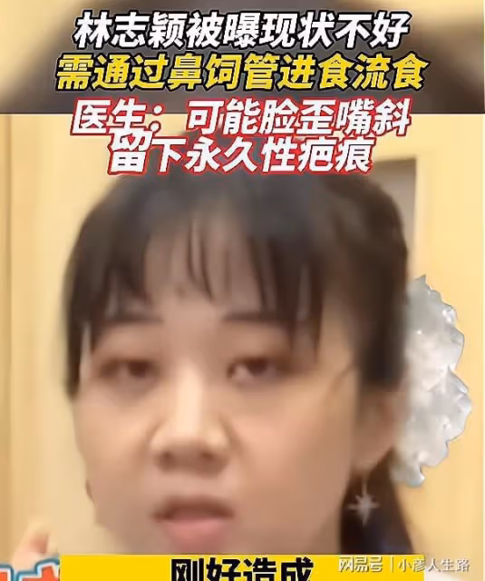 林志穎顏面手術惡化!醫生透露:可能臉歪嘴斜,留永久性疤痕