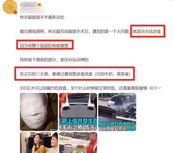 林志穎出院了!醫院院長否認插管,稱術後情況良好,已回家休養