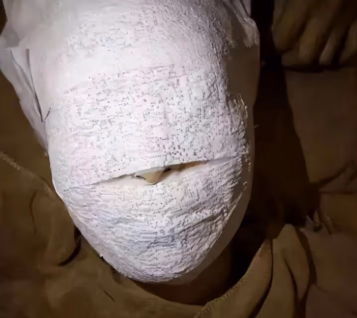 林志穎出院了!醫院院長否認插管,稱術後情況良好,已回家休養