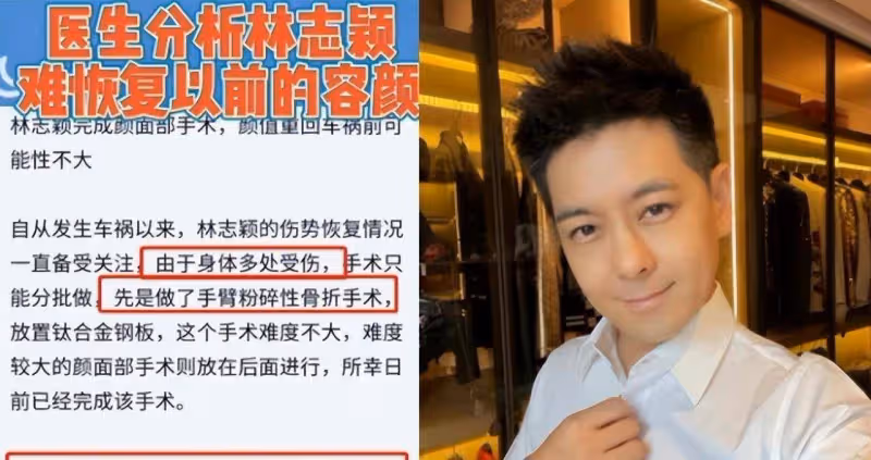 林志穎出院了!醫院院長否認插管,稱術後情況良好,已回家休養