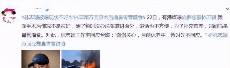 林志穎出院了!醫院院長否認插管,稱術後情況良好,已回家休養