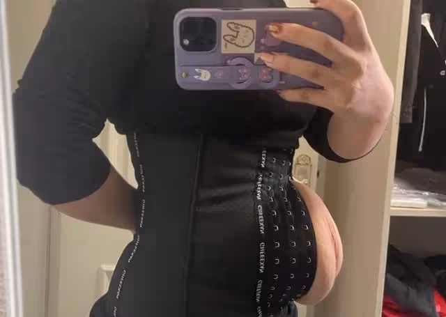 2胎都是雙胞胎,寶媽束腰扣不上看著妊娠紋無奈,網友心疼:做媽媽太不容易了