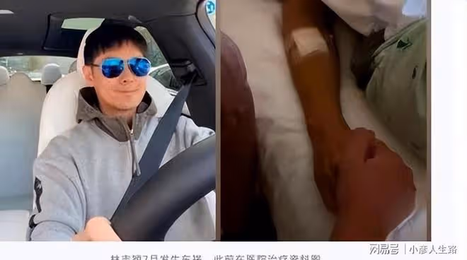 時隔35天林志穎首發文,稱已返回家休養,隻字不提車禍始末