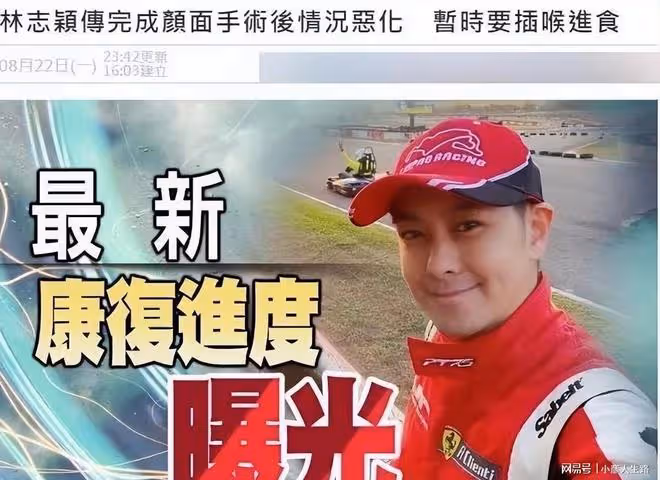 時隔35天林志穎首發文,稱已返回家休養,隻字不提車禍始末